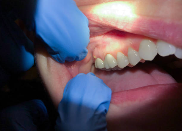 Best Orthodontic Emergency Dentist in Alorton, IL