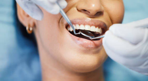 Best Emergency Dentist for Knocked-Out Tooth in Alorton, IL