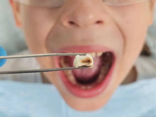 Best Urgent Dental Care for Toothache in Alorton, IL